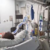 La Unidad de Reanimación del Hospital de León contará con una inversión de 6,3 millones