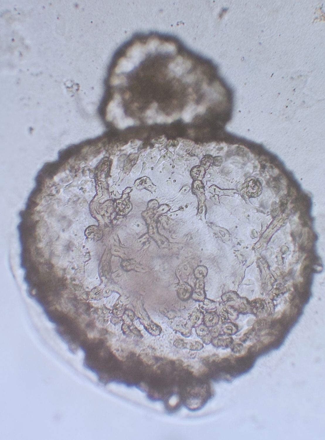 Ejemplo de organoide 